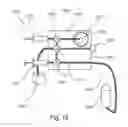 Fig. 13 - Fluid delivery systems for delivery of pharmaceutical fluids