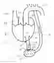 Fig. 01 - HEART ASSIST DEVICE, CANNULA AND FILTER THEREFOR