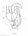 Fig. 02 - HEART ASSIST DEVICE, CANNULA AND FILTER THEREFOR