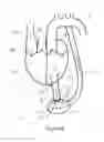Fig. 07 - HEART ASSIST DEVICE, CANNULA AND FILTER THEREFOR