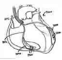 Fig. 01 - Devices and methods for assisting heart function