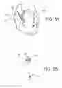 Fig. 06 - Devices and methods for assisting heart function