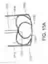 Fig. 22 - Devices and methods for assisting heart function