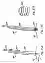 Fig. 25 - Devices and methods for assisting heart function