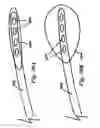 Fig. 40 - Devices and methods for assisting heart function