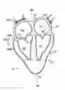 Fig. 01 - COMPLIANT CARDIAC SUPPORT DEVICE