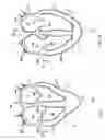 Fig. 02 - COMPLIANT CARDIAC SUPPORT DEVICE