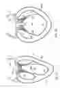 Fig. 03 - COMPLIANT CARDIAC SUPPORT DEVICE