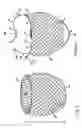 Fig. 06 - COMPLIANT CARDIAC SUPPORT DEVICE
