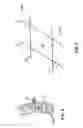 Fig. 07 - COMPLIANT CARDIAC SUPPORT DEVICE