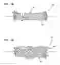 Fig. 19 - COMPLIANT CARDIAC SUPPORT DEVICE