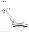 Fig. 07 - Transverse surgical tunneling