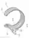 Fig. 19 - Low-profile surgical access devices with anchoring