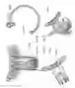 Fig. 20 - Low-profile surgical access devices with anchoring