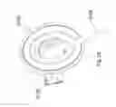 Fig. 23 - Low-profile surgical access devices with anchoring