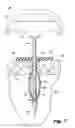 Fig. 04 - Devices for and methods of performing minimally-invasive surgical procedures through a single incision