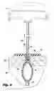 Fig. 05 - Devices for and methods of performing minimally-invasive surgical procedures through a single incision