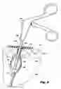 Fig. 06 - Devices for and methods of performing minimally-invasive surgical procedures through a single incision