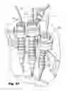 Fig. 29 - Devices for and methods of performing minimally-invasive surgical procedures through a single incision