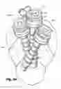 Fig. 32 - Devices for and methods of performing minimally-invasive surgical procedures through a single incision