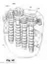 Fig. 33 - Devices for and methods of performing minimally-invasive surgical procedures through a single incision