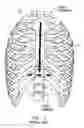 Fig. 02 - Methods and apparatus for performing minimally invasive surgery