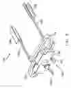 Fig. 10 - Methods and apparatus for performing minimally invasive surgery