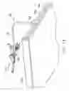 Fig. 14 - Methods and apparatus for performing minimally invasive surgery