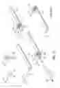 Fig. 22 - Methods and apparatus for performing minimally invasive surgery