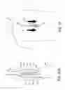 Fig. 28 - Methods and apparatus for performing minimally invasive surgery