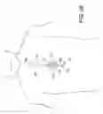 Fig. 29 - Methods and apparatus for performing minimally invasive surgery