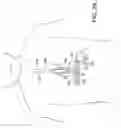 Fig. 30 - Methods and apparatus for performing minimally invasive surgery