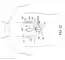 Fig. 33 - Methods and apparatus for performing minimally invasive surgery