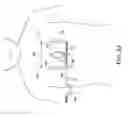 Fig. 34 - Methods and apparatus for performing minimally invasive surgery