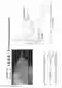 Fig. 13 - Noninvasive detection of elements and/or chemicals in biological matter
