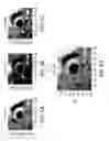Fig. 04 - Automated methods and systems for vascular plaque detection and analysis