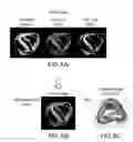 Fig. 06 - Automated methods and systems for vascular plaque detection and analysis