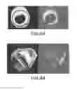 Fig. 10 - Automated methods and systems for vascular plaque detection and analysis