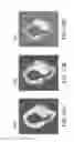 Fig. 12 - Automated methods and systems for vascular plaque detection and analysis