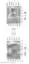 Fig. 13 - Automated methods and systems for vascular plaque detection and analysis