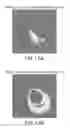 Fig. 14 - Automated methods and systems for vascular plaque detection and analysis
