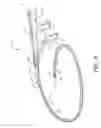 Fig. 02 - NAVIGATION ENABLED LEAD DELIVERY CATHETER