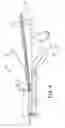 Fig. 06 - NAVIGATION ENABLED LEAD DELIVERY CATHETER