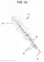 Fig. 02 - Devices and methods for securing a catheter within a heart
