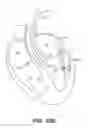 Fig. 131 - DIAGNOSTIC CATHETERS, GUIDE CATHETERS, VISUALIZATION DEVICES AND CHORD MANIPULATION DEVICES, AND RELATED KITS AND METHODS