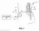 Fig. 02 - USER INTERFACE THAT DISPLAYS PENDING AND SELECTED PROGRAMMING FOR AN IMPLANTABLE MEDICAL DEVICE