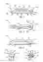 Fig. 02 - Surgical ligation clip