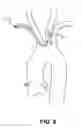 Fig. 07 - Intravascular blood filter