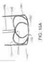Fig. 22 - SYSTEMS AND METHODS FOR CLOSING AN APERTURE IN A BODILY TISSUE