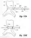 Fig. 07 - Laminoplasty apparatus and methods